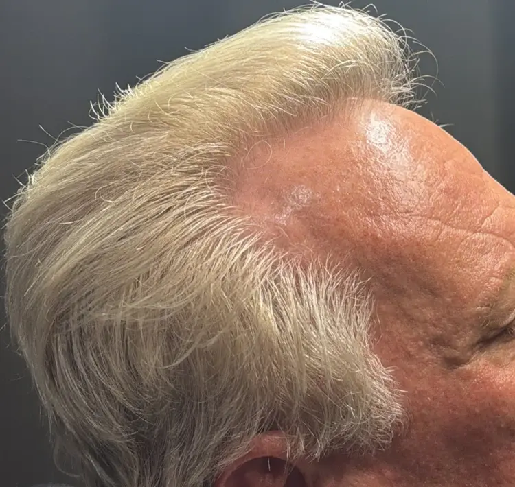 Jerry after Folix treatment