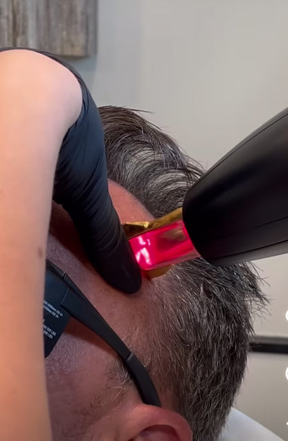Folix Laser Hair Restoration Treatment